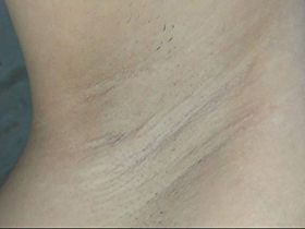 300人の腋 2　サンプル画像11